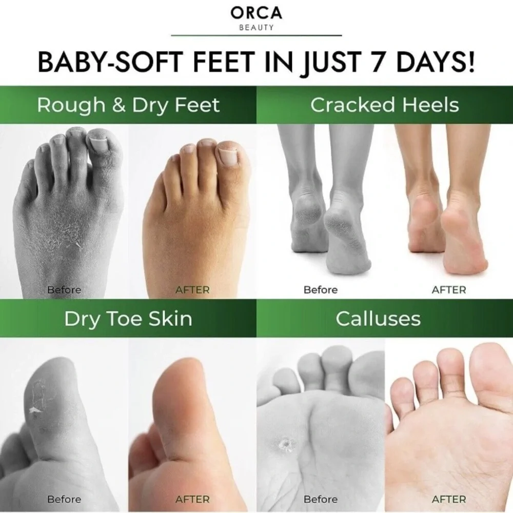 Orca Beauty Foot‎ Peel Mask, New in Box, Pais of (8)
